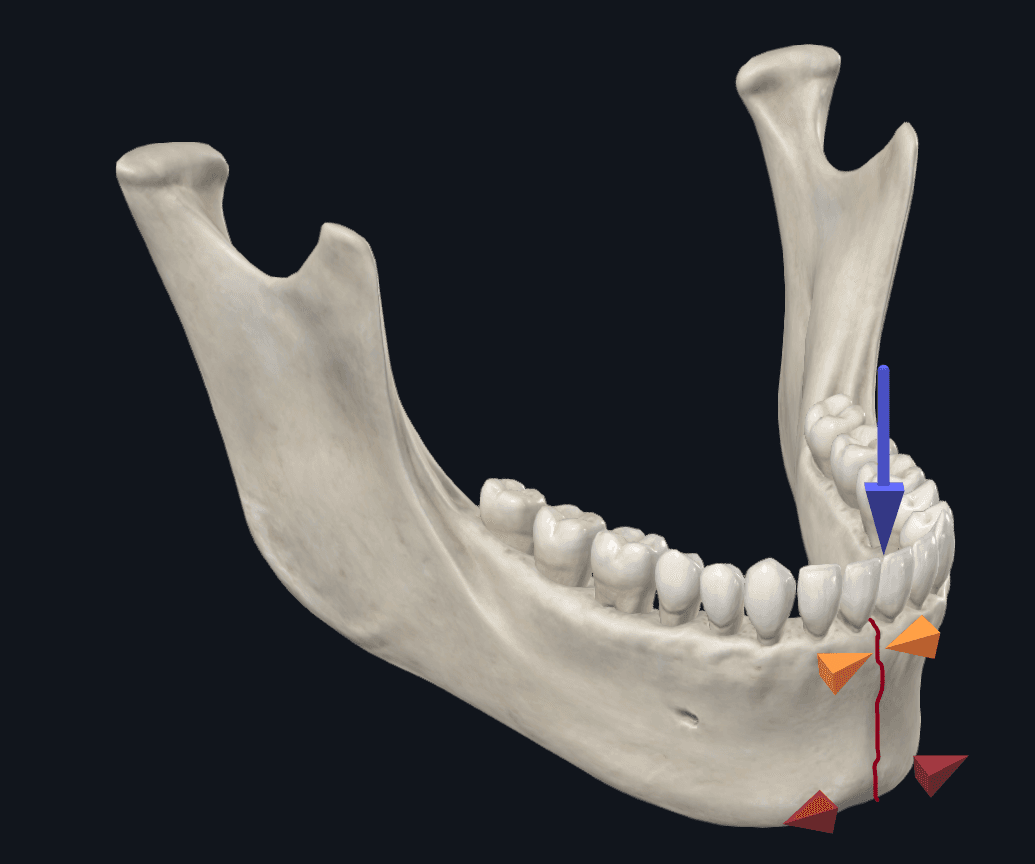 0414Figure4a