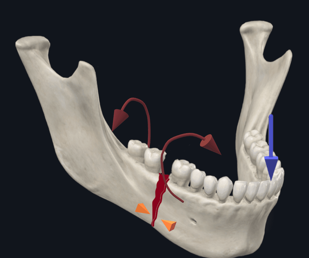 0414Figure6a