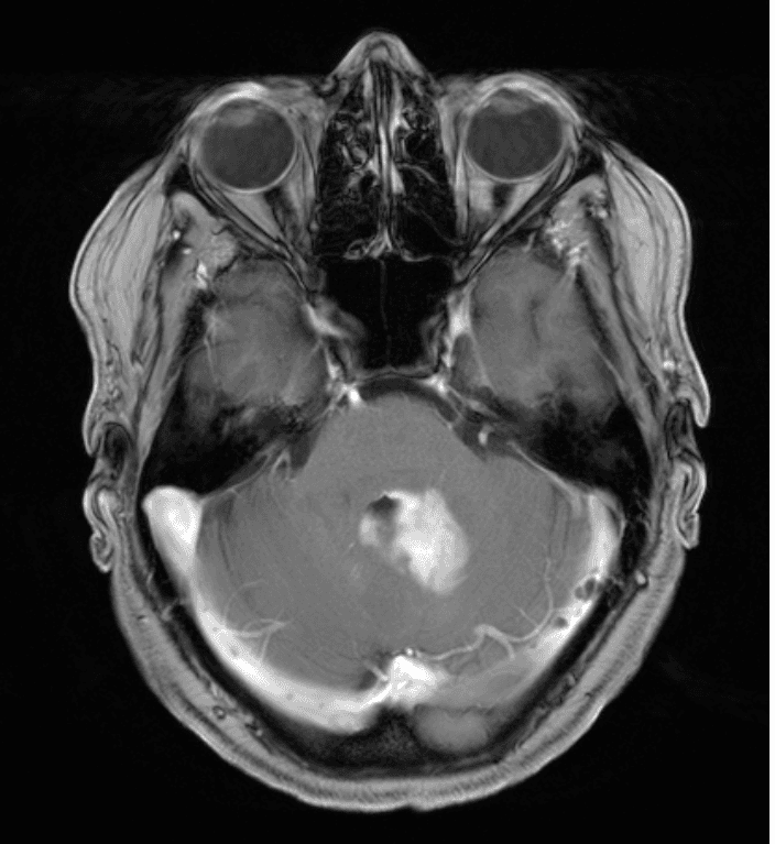 Fig.1a