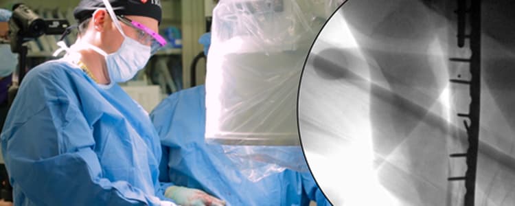 open-reduction-and-internal-fixation-of-a-diaphyseal-humeral-fracture